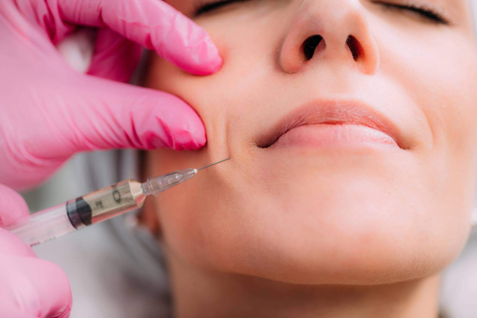 The Best Dermal Fillers Of 2022 Medeurostore