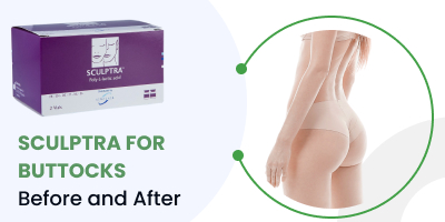 sculptra for buttocks before and after