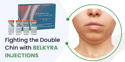 Fighting the Double Chin with Belkyra Injections