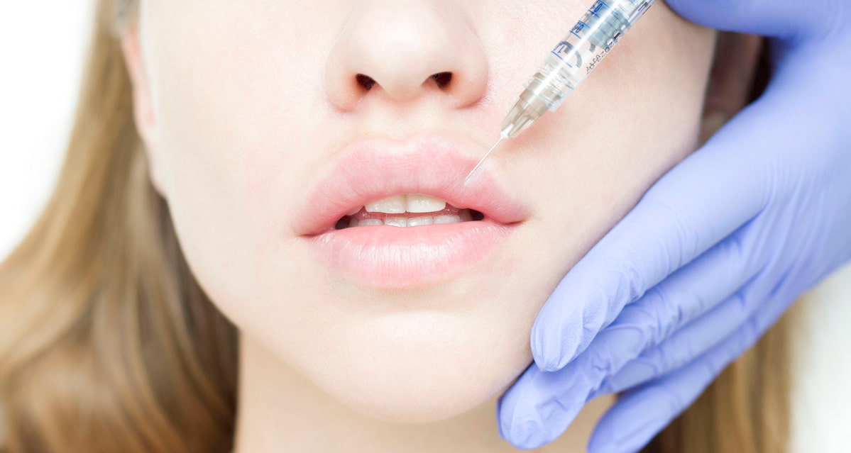 Restylane injections