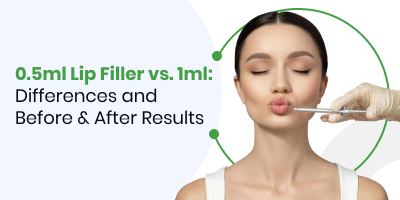 0.5ml Lip Filler vs. 1ml: Differences and Before & After Results