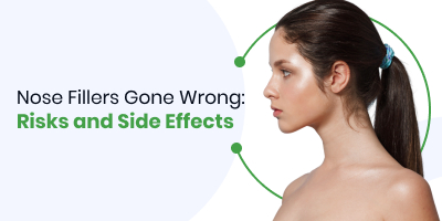 Nose Fillers Gone Wrong: Risks and Side Effects