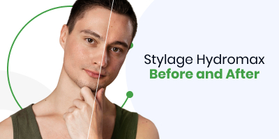 Stylage Hydromax Before and After