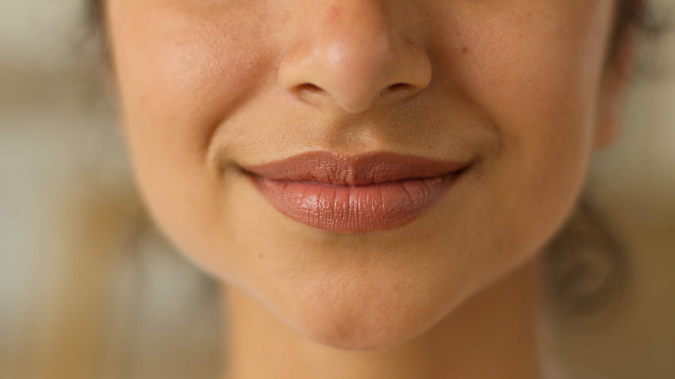 My Juvederm Swelling 6 Months Later