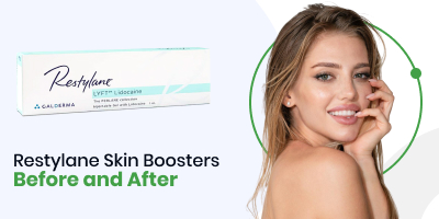 Restylane Skin Boosters Before and After