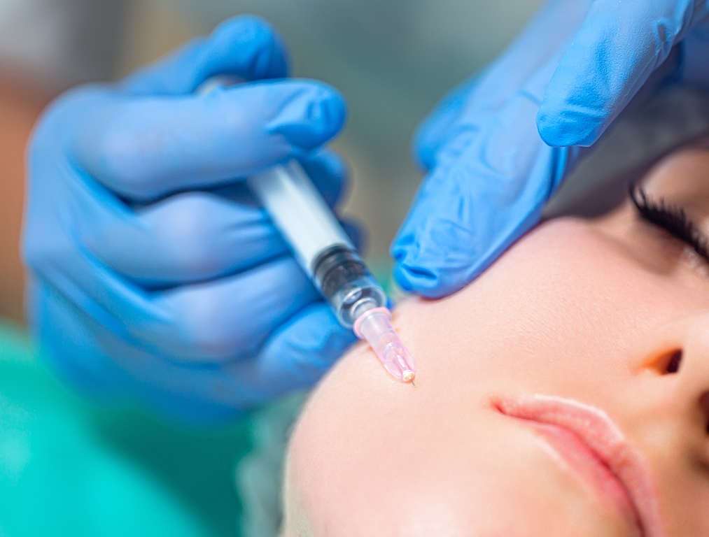 Juvederm for Gummy Smile Before and After Results